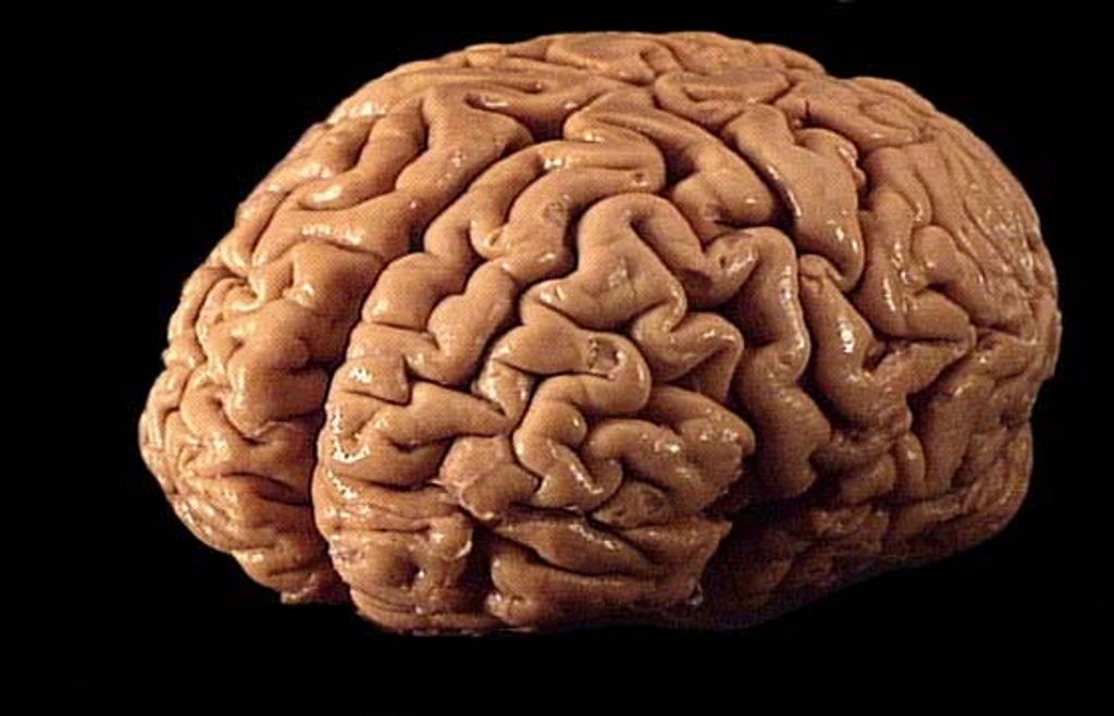 brain4-746462-Original preview